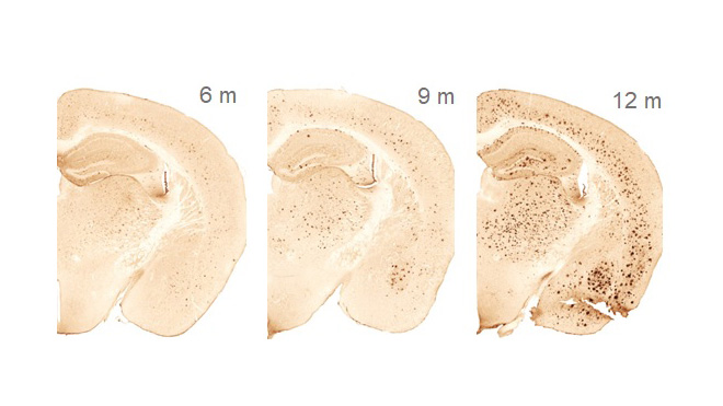 Diese Abbildung zeigt histologische Querschnitte eines Gehörgangs bei 6 Metern, 9 Metern und 12 Metern embryonichem Entwicklungsstadium.

Die Schnitte verdeutlichen die strukturelle Veränderung und Ausreifung während der Entwicklung.