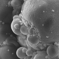 This is a scanning electron microscope image showing clustered, irregularly-shaped cells with rough textured surfaces, some covered with small granular particles. The microorganisms are likely lymphocytes, possibly undergoing blanche formation.