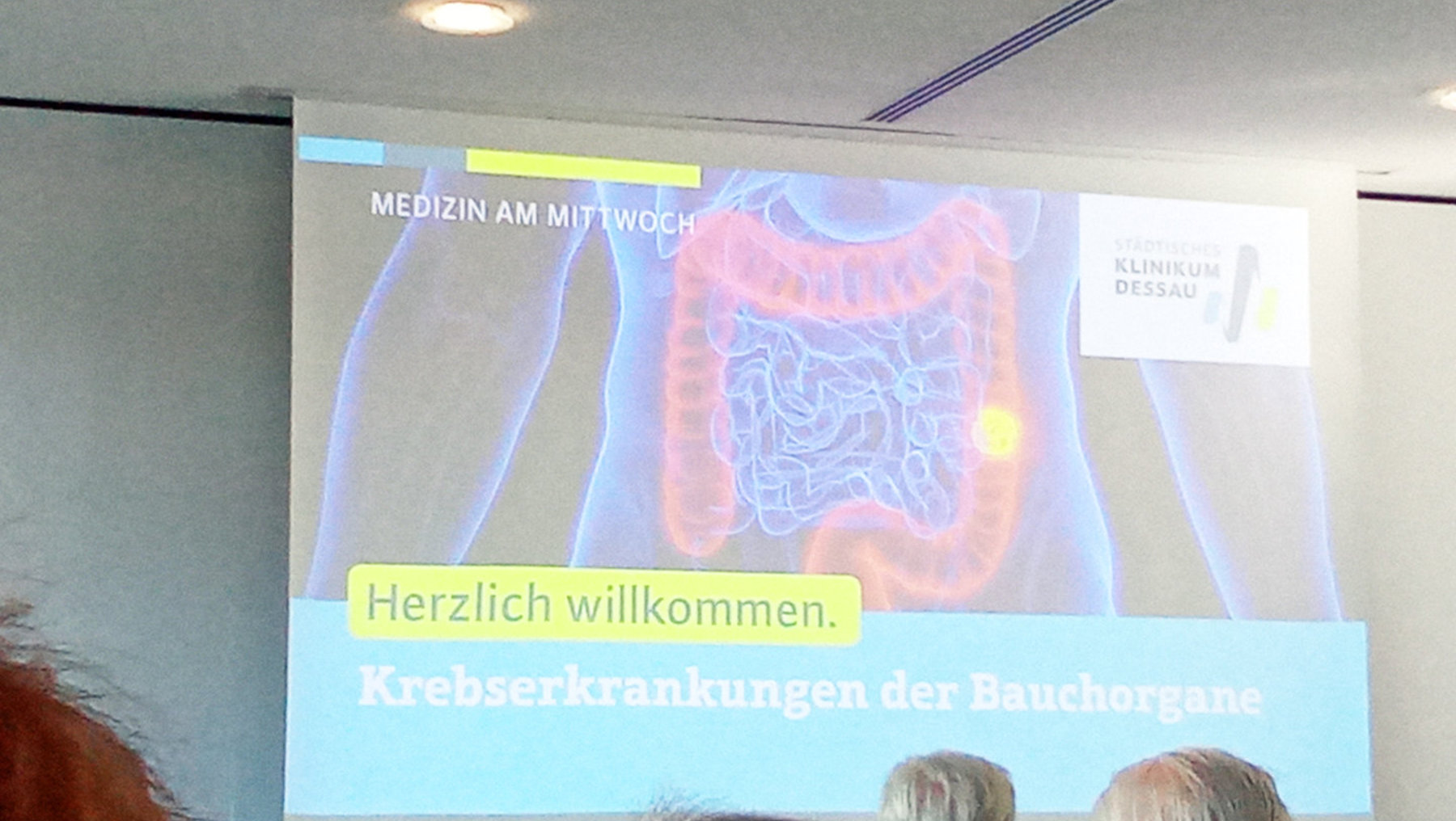 Präsentation zu „Krebserkrankungen der Bauchorgane“ mit einer Grafik des menschlichen Verdauungssystems, insbesondere des Darms und Magens, beleuchtet. Titel „Herzlich willkommen“ und Veranstaltungsreihe „Medizin am Mittwoch“.