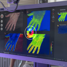 Medizinische Handanalyse mit Farbkarten zur Darstellung verschiedener Gewebeindizes wie Wasser- und Fettverteilung. Eine Hand wird in natürlicher Ansicht sowie in drei farbigen Messbildern gezeigt, die unterschiedliche Gewebeeigenschaften visualisieren.