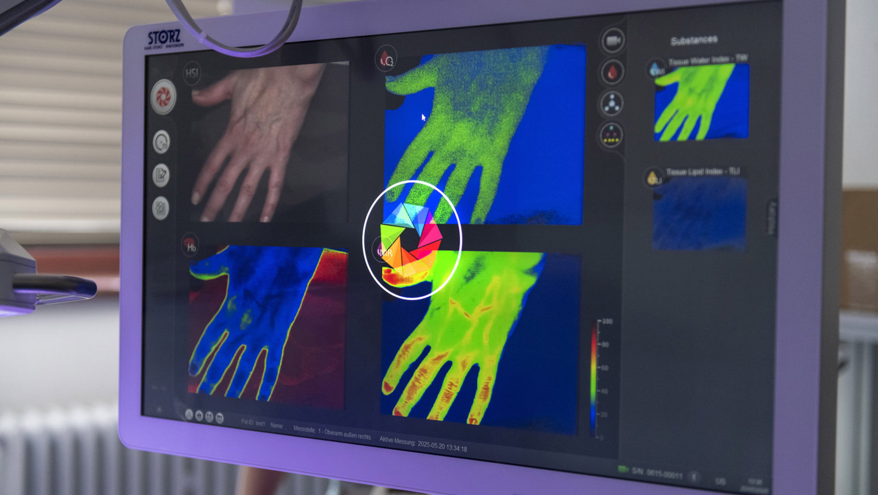 Medizinische Handanalyse mit Farbkarten zur Darstellung verschiedener Gewebeindizes wie Wasser- und Fettverteilung. Eine Hand wird in natürlicher Ansicht sowie in drei farbigen Messbildern gezeigt, die unterschiedliche Gewebeeigenschaften visualisieren.